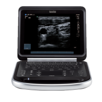 Fujifilm Sonosite Edge Аппарат УЗИ