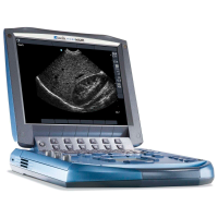 Fujifilm Sonosite Micromaxx Аппарат УЗИ