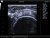 UltraSonix SonixOP Аппарат УЗИ