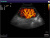 Sonoscape S40 Exp Аппарат УЗИ
