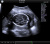 UltraSonix SonixTouch Аппарат УЗИ