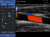Healcerion Sonon 300L Аппарат УЗИ