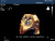 Philips iE33 Аппарат УЗИ