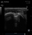 Healcerion Sonon 300C Аппарат УЗИ
