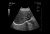 Healcerion Sonon 300C Аппарат УЗИ